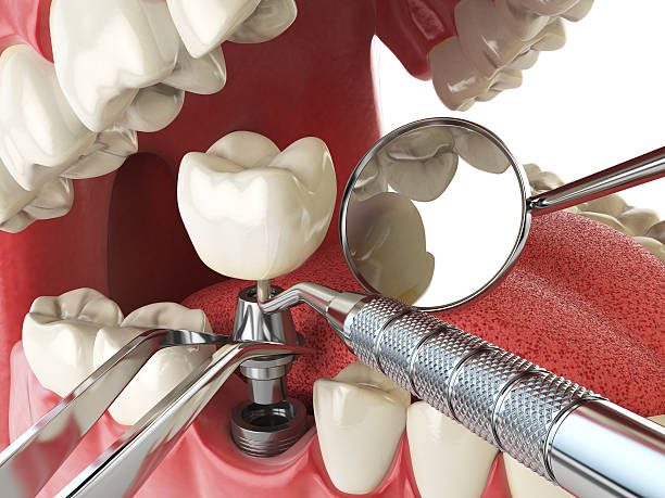 Best Emergency Treatment for Oral Infections in Madison, AL